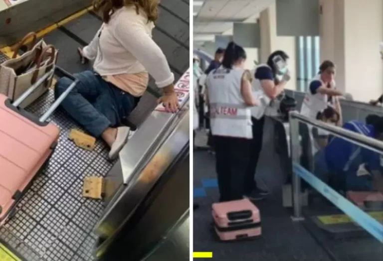 mujer_perdio_la_pierna_al_quedar_atrapada_en_cinta_transportadora_3.jpg